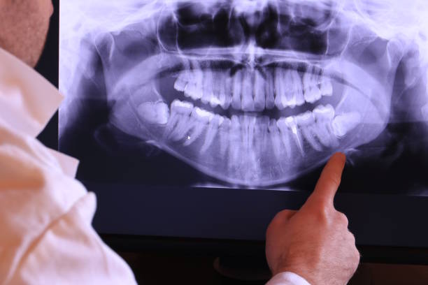 Best Emergency Treatment for Toothache in Spearman, TX