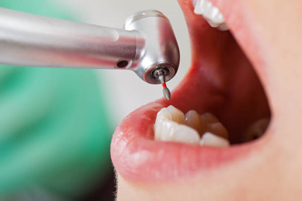 Best After-Hours Emergency Dentist in Spearman, TX